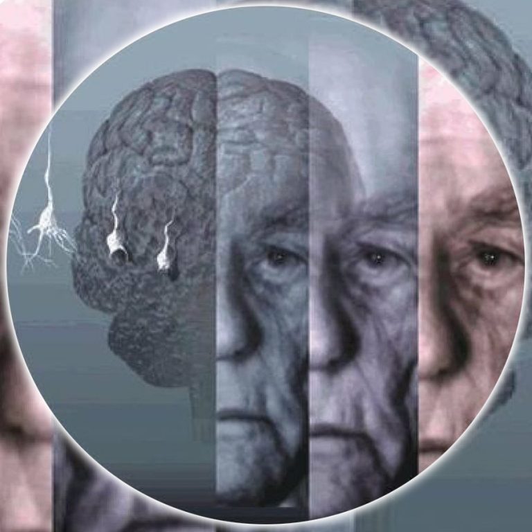 Fitofármacos: Ginkgo biloba, circulación cerebral, memoria y demencia senil