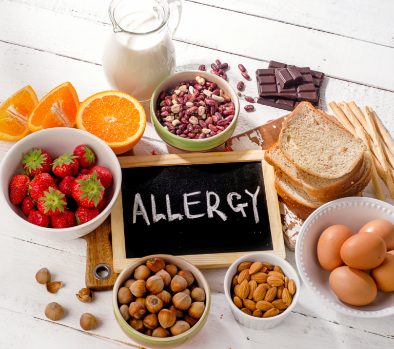 Alergias alimentarias