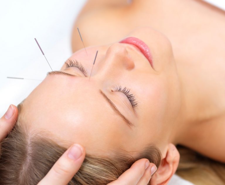 La acupuntura en la estética facial