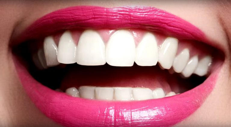 Dientes: cómo cuidarlos para que brillen siempre