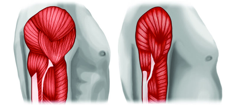 SARCOPENIA: pérdida de fuerza y el funcionamiento muscular en los adultos mayores… y no tanto