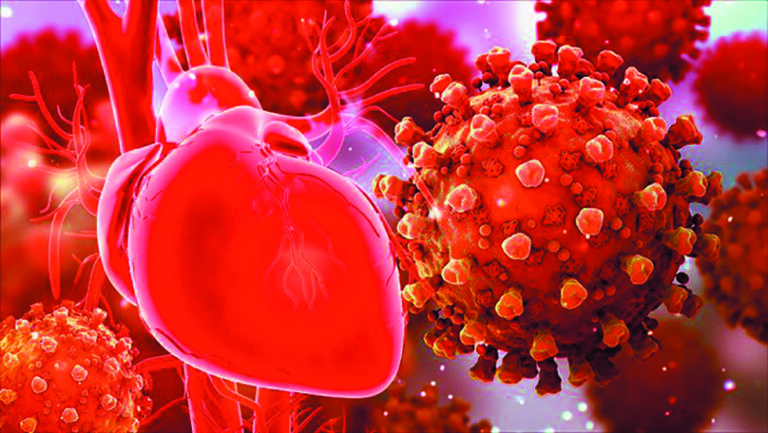 Problemas cardiovasculares asociados al Covid-19: rol de los probióticos en su prevención