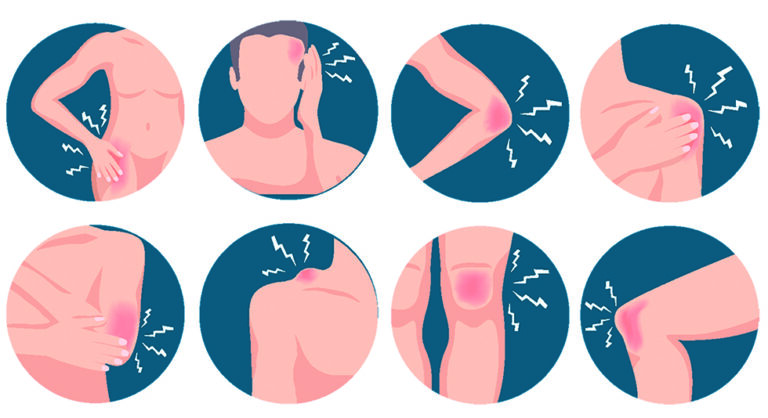 Síntomas corporales del Long COVID y su similitud con la fibromialgia