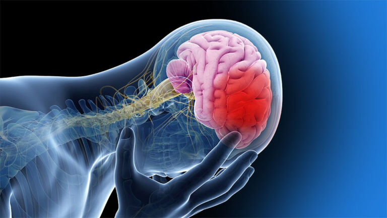 El 90% de los ataques cerebrovasculares pueden prevenirse