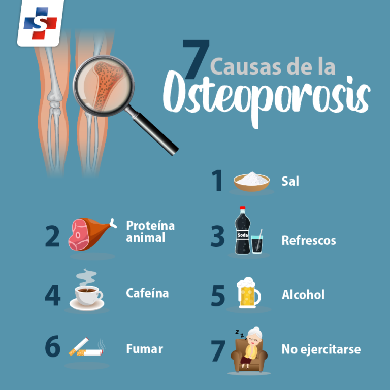 Osteoporosis, las mujeres son las más propensas