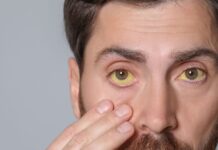 Hepatitis: una crisis silenciosa, pero evitable